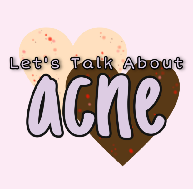 Acne, although common, is not talked about often enough and the struggles that having acne can cause need to be further understood.