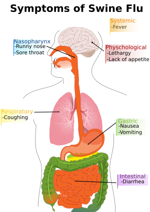 Main symptoms of swine influenza. (See Wikiped...